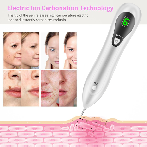 Xpreen Mole Remover Pen, Skin Tag Remover Dark Spot Remover Freckle Tattoo Wart Mole Removal Tool with LCD Screen and Spotlight