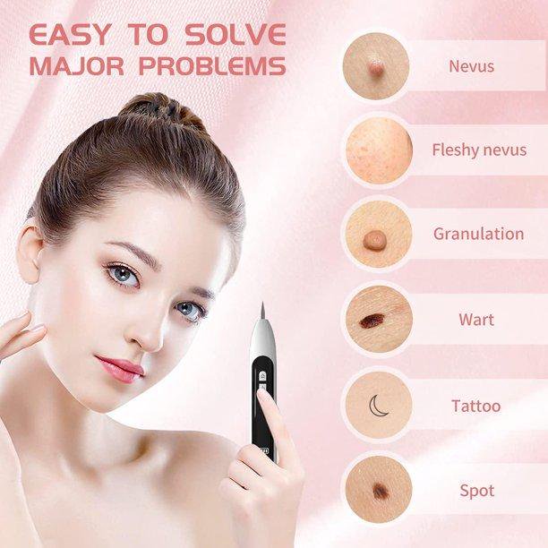 Mole Remover Pen, Wireless LCD Laser Plasma Pen Wart Remover Mole Tattoo Remover Machine Skin Tag