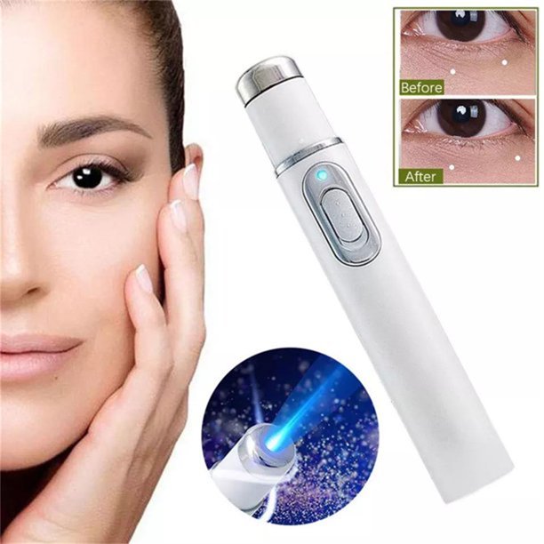 Xpreen Blue Light Pen ,acne scar treatment Machine For Acne Scar Removalfor face, Improve Skin Elasticity,Skin Tightening Wrinkle Removal