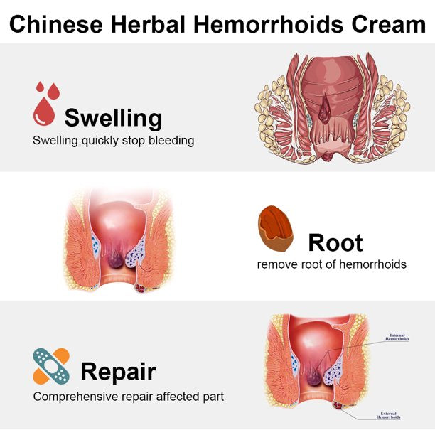 Dictamni Hemorrhoids, Natural Herbal Anal Cream, Hemorrhoid Pain Relief Products